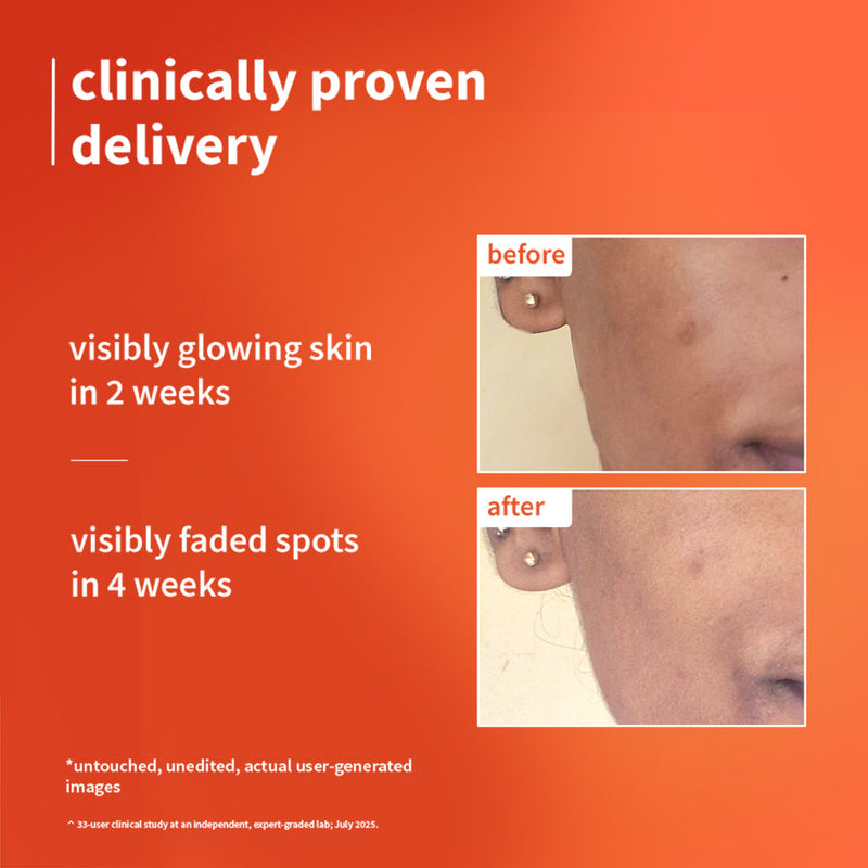 1% Vitamin C Ultra-Light-Glow Boosting Gel Cream with Alpha Arbutin