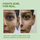Green Tea Pore Cleansing Face Wash - 150 ml