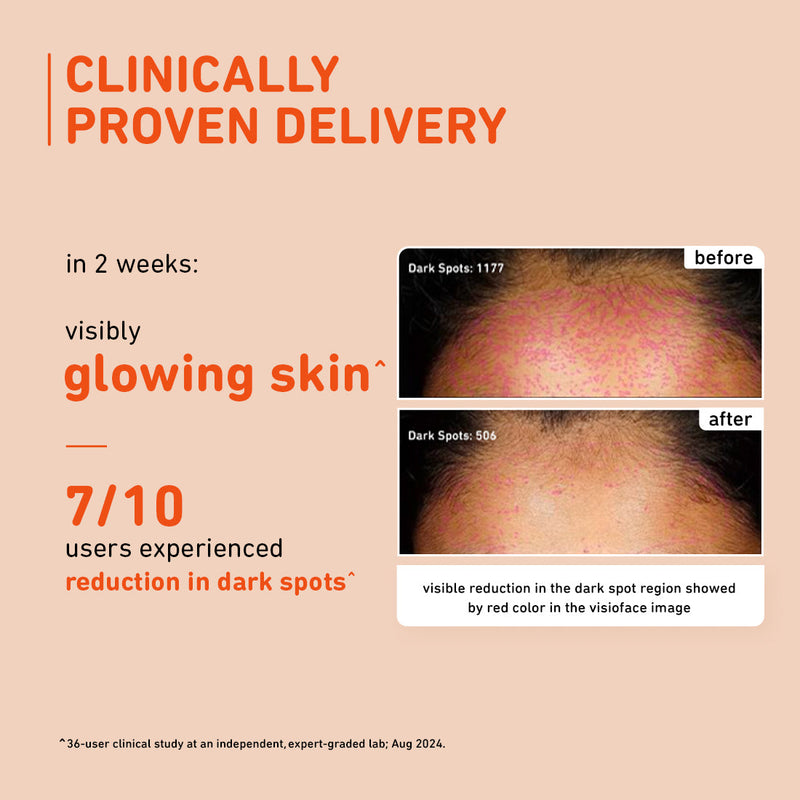 15% Vitamin C Serum with Mandarin for glowing skin