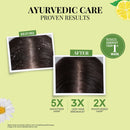 Anti Dandruff Shampoo | Lemon, Bhringraj & 12 Herbs