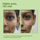 Green Tea Pore Cleansing Face Wash | 50 ml