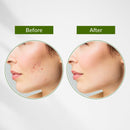 Neem, Tulsi & Salicylic Acid Purifying Face Gel