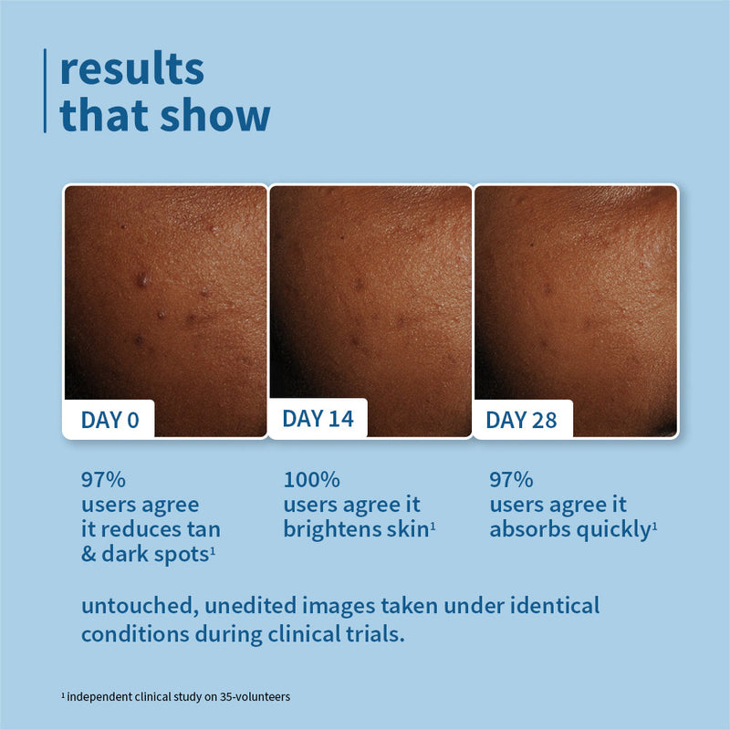 2% Niacinamide & Rice Water SPF 50 PA++++ Brightening Sunscreen