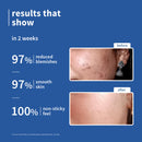 10% Niacinamide & Rice Water Brightening Face Serum- 15ml**