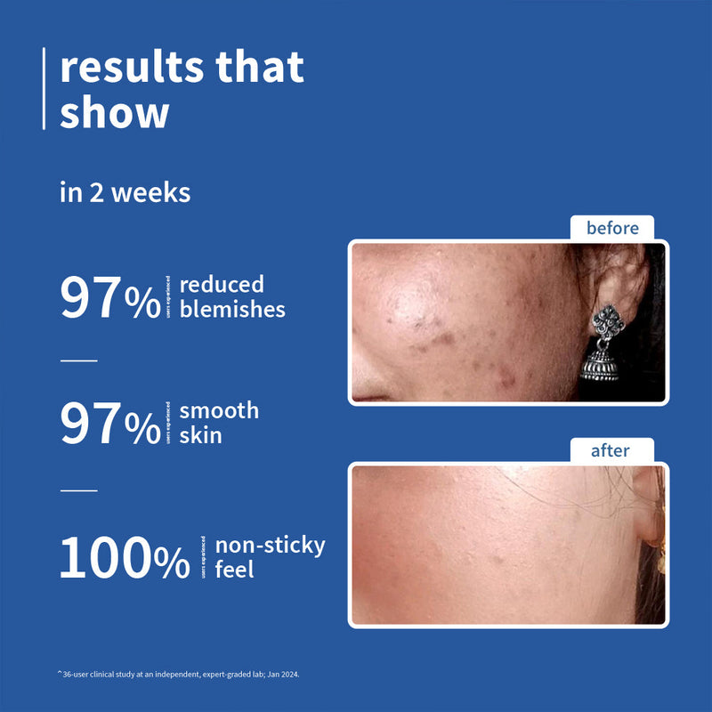 10% Niacinamide & Rice Water Brightening Face Serum- 15ml**